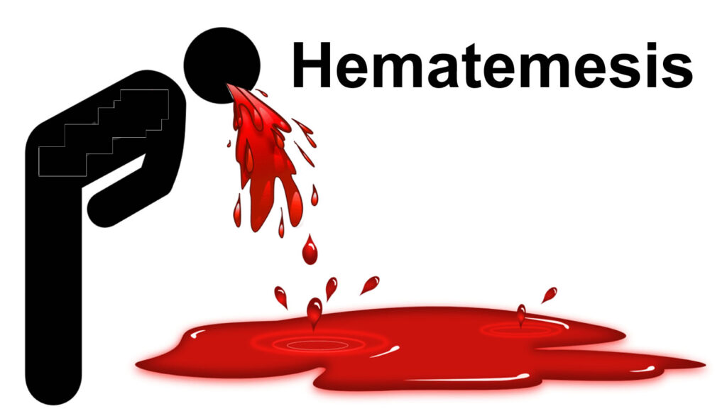 Top Hematemesis Doctors in West Delhi